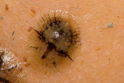  Coccus Linnaeus, 1758