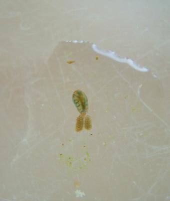  Cyclopidae Rafinesque, 1815