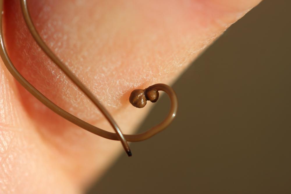  Chordodidae 