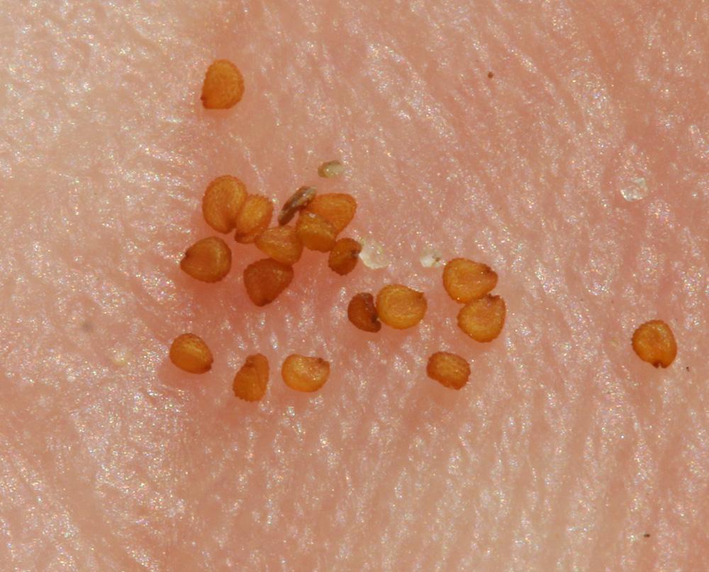 Céraiste aggloméré Cerastium glomeratum Thuill., 1799