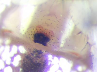 Théridion ovoïde Enoplognatha ovata (Clerck, 1758)