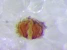  Thanatus vulgaris Simon, 1870