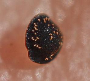 Spergule des champs, Espargoutte des champs, Sparg Spergula arvensis L., 1753